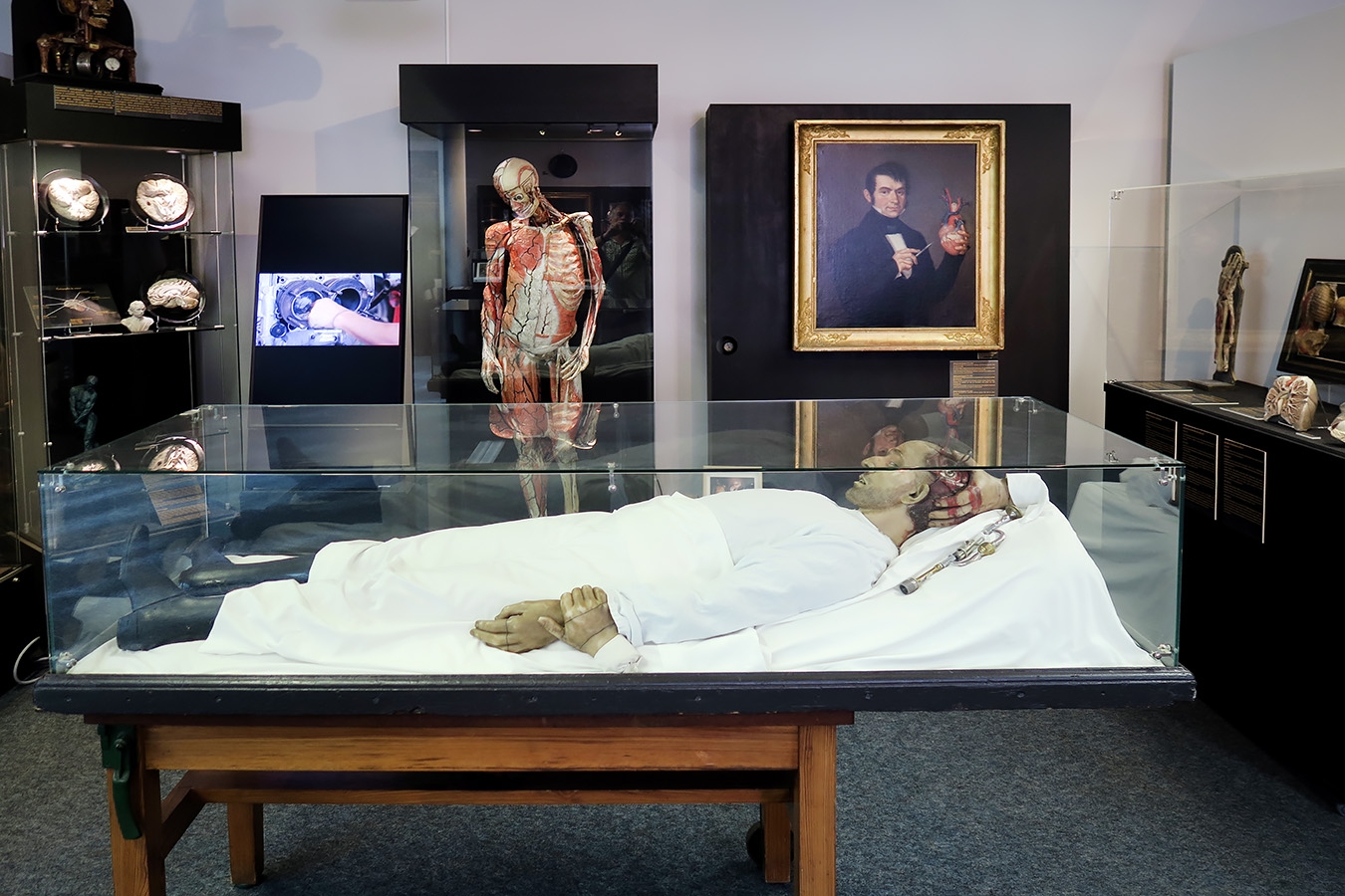 geneeskundemuseum brussel 8-2025 3091