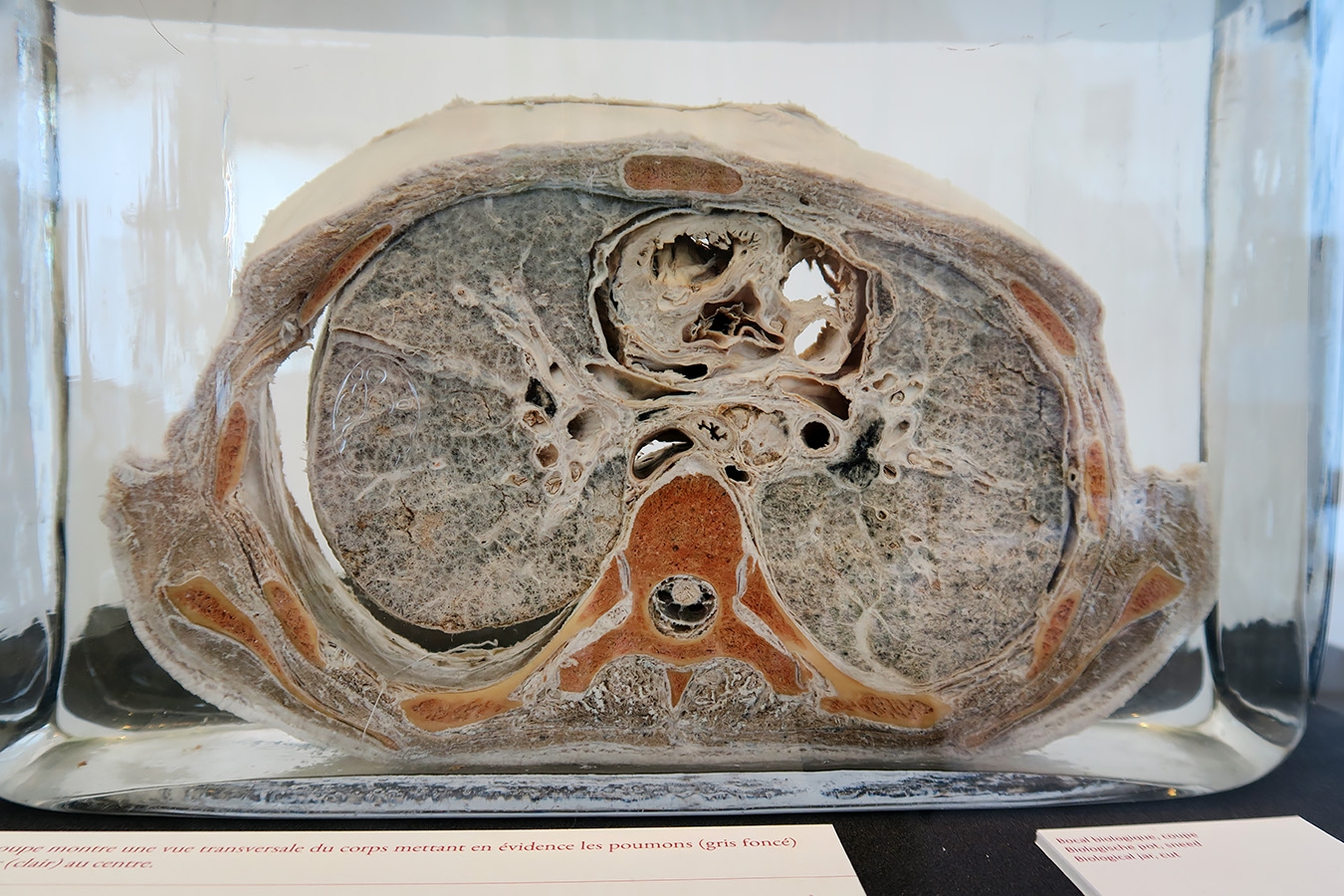 geneeskundemuseum brussel 8-2025 3153