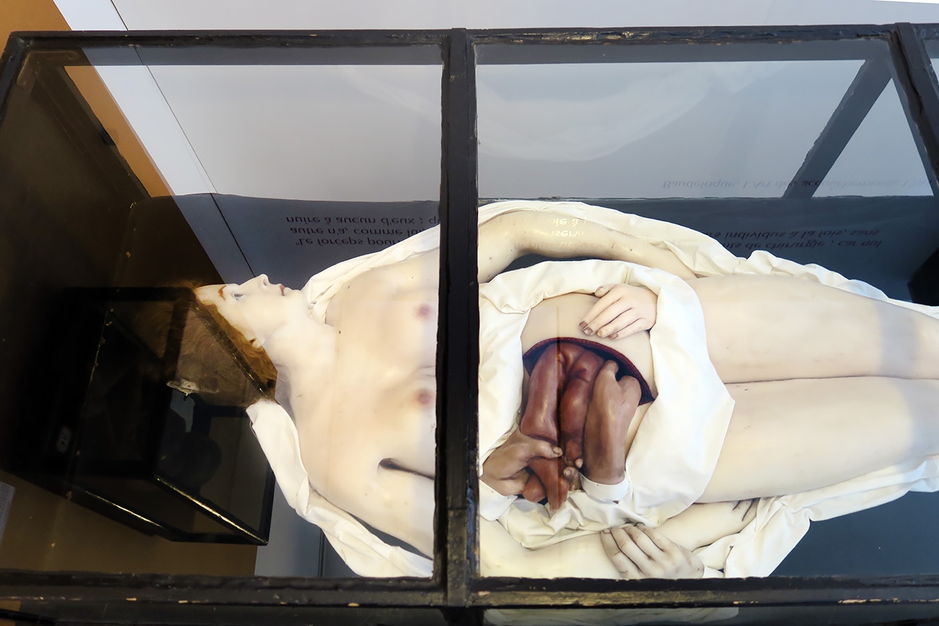 geneeskundemuseum brussel 8-2025 3160