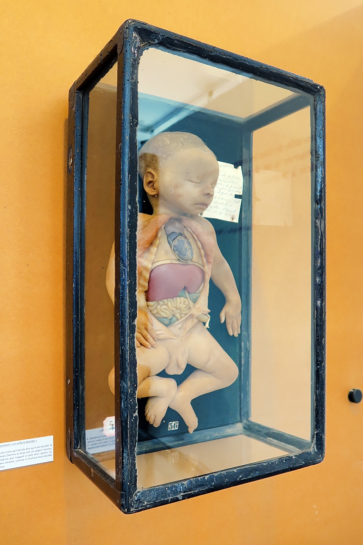 geneeskundemuseum brussel 8-2025 3161