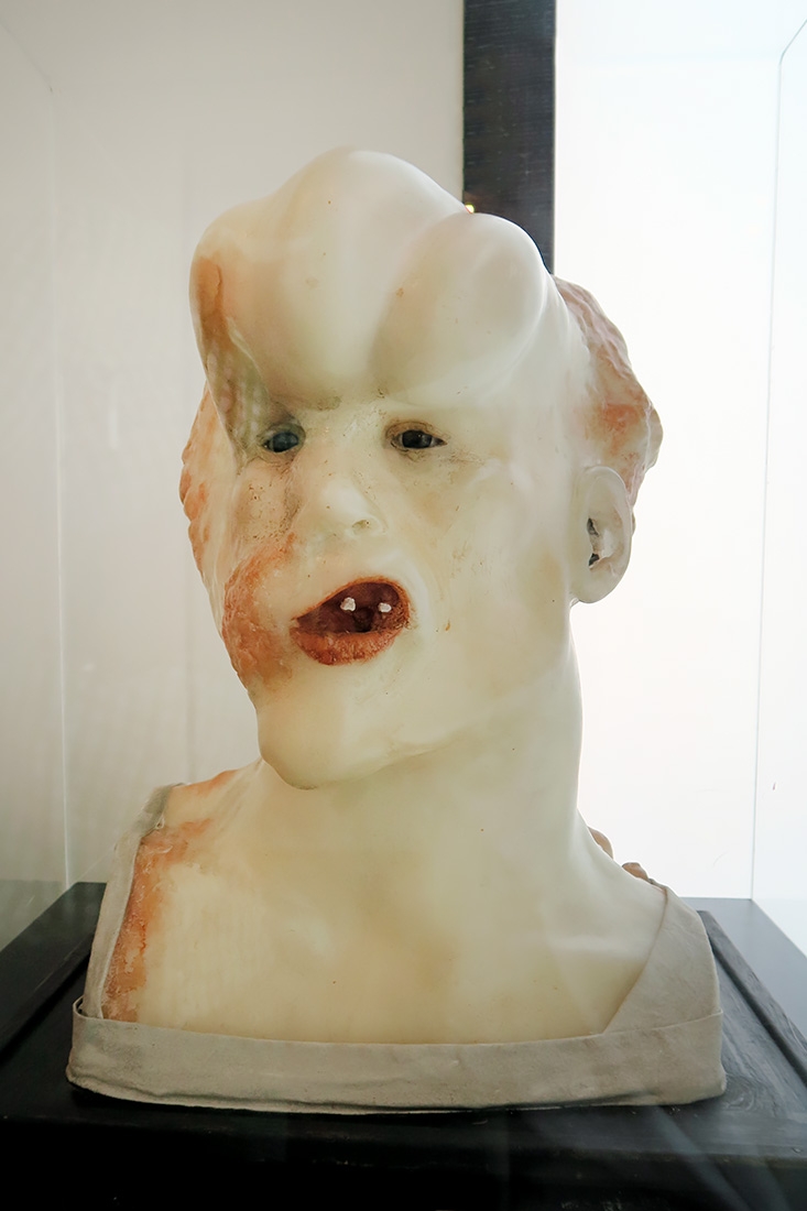 geneeskundemuseum brussel 8-2025 3170