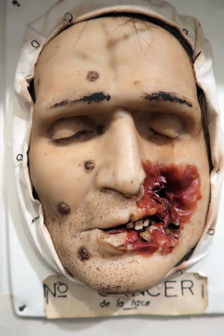 geneeskundemuseum brussel 8-2025 3183