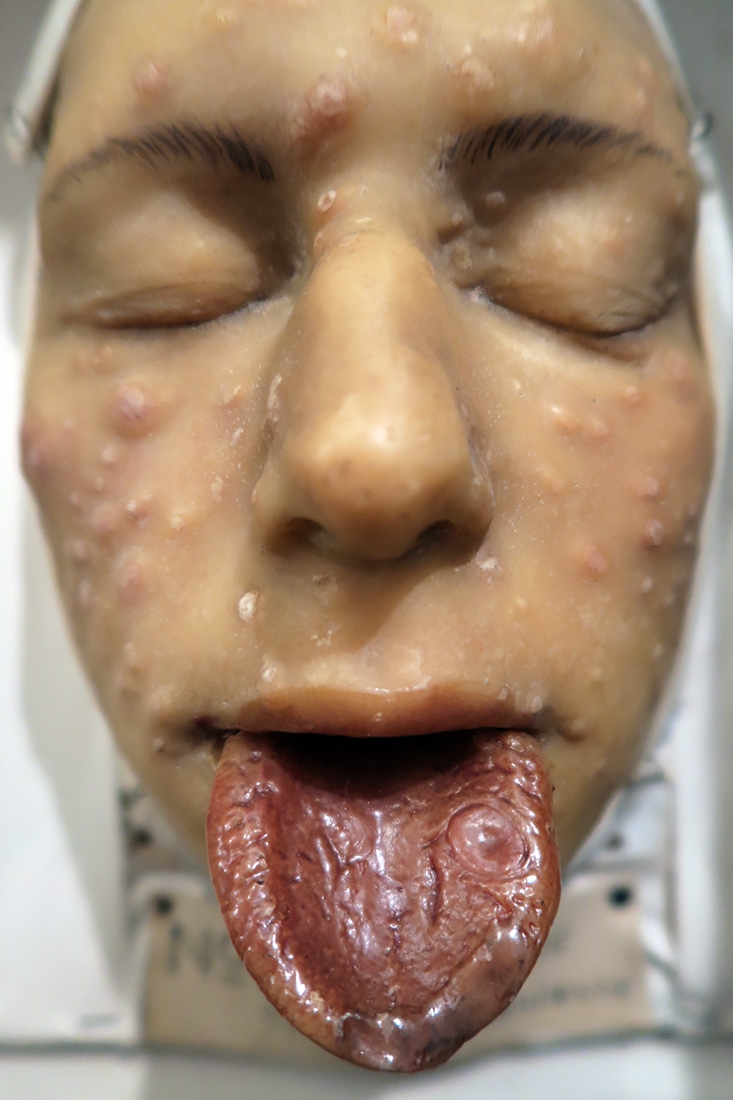 geneeskundemuseum brussel 8-2025 3184