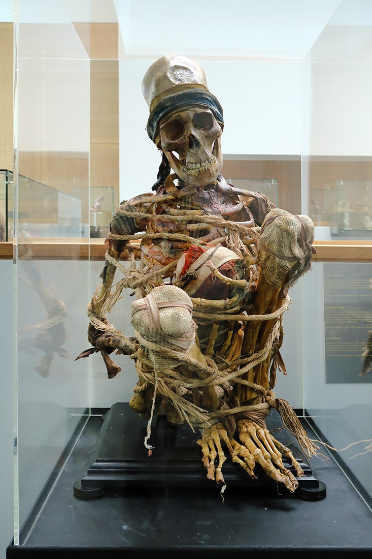 geneeskundemuseum brussel 8-2025 3202