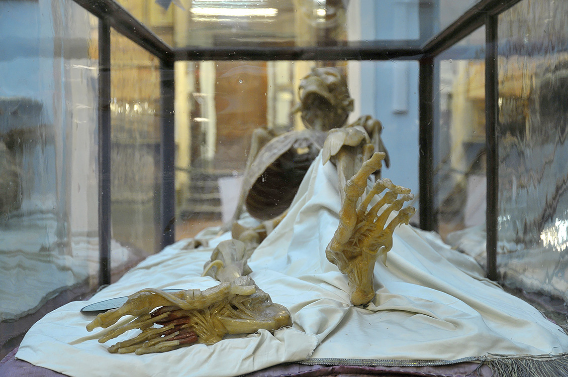 la specola anatomische modellen 8-2017 0824