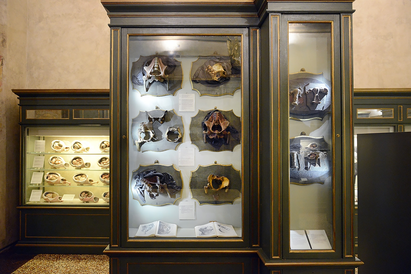 museo ostetrico giovan antonio galli bologna 8-2022 4022