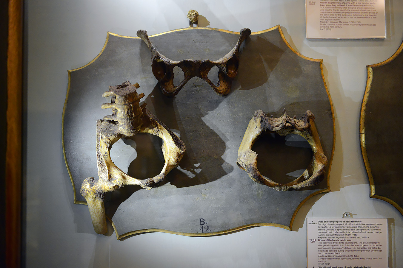 museo ostetrico giovan antonio galli bologna 8-2022 4156