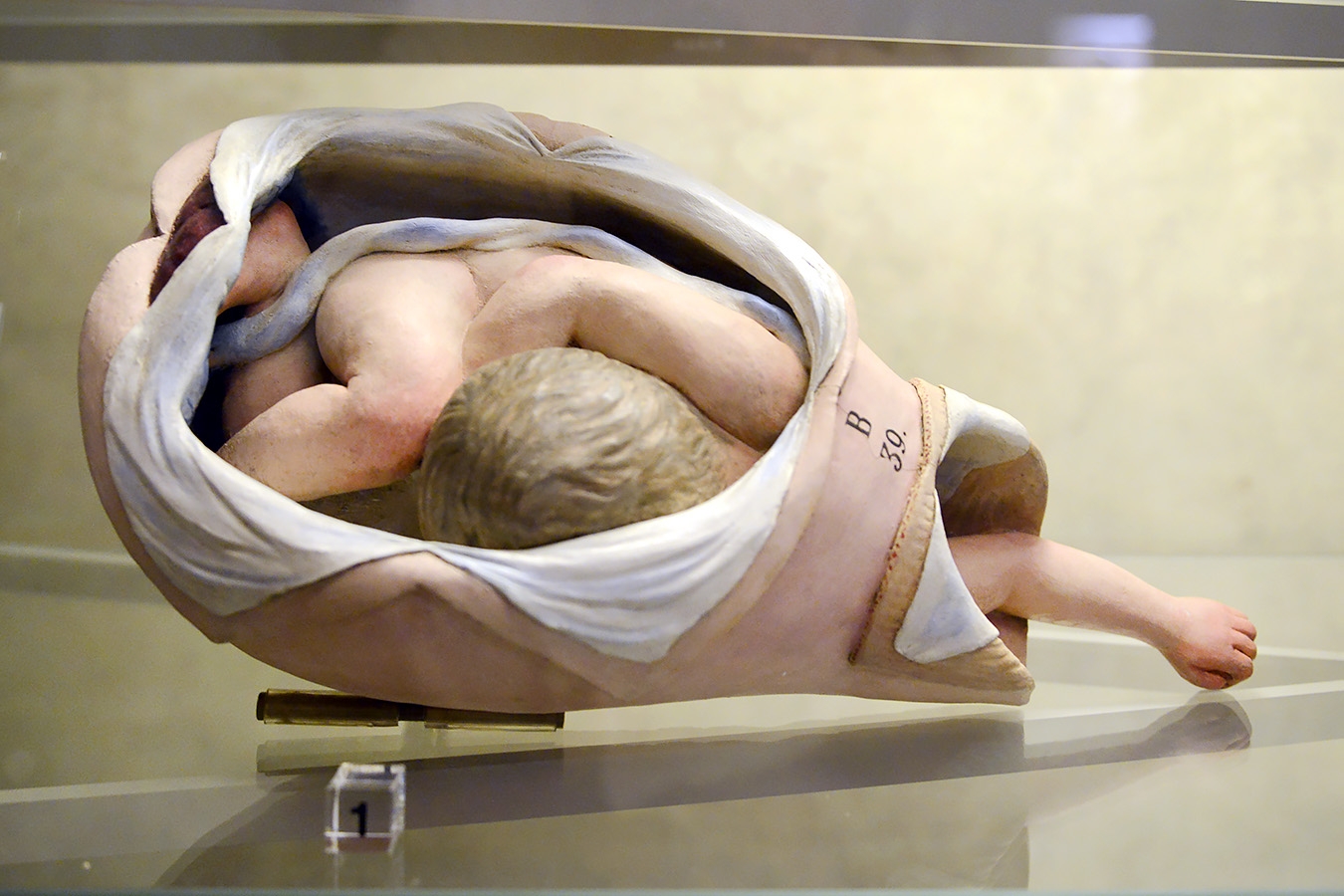 museo ostetrico giovan antonio galli bologna 8-2022 4713