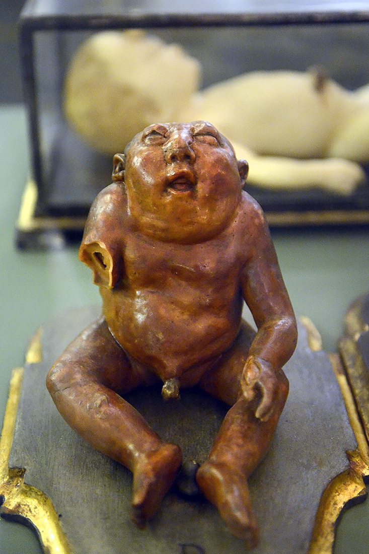 museo ostetrico giovan antonio galli bologna 8-2022 4796
