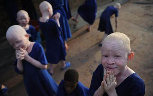 albino kinderen