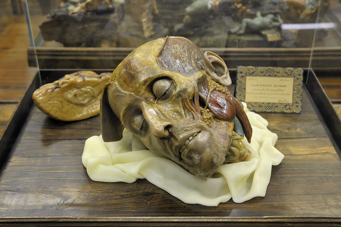 gaetano zumbo 8-2017 1485