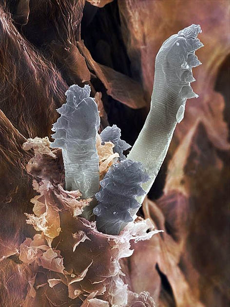 wimpermijtkopjes demodex folliculorum